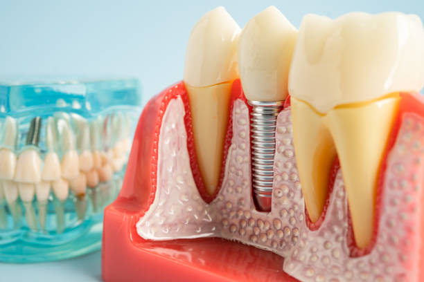 Best Dental Studio in Dana Point, CA